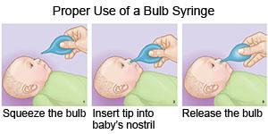 how to use bulb syringe