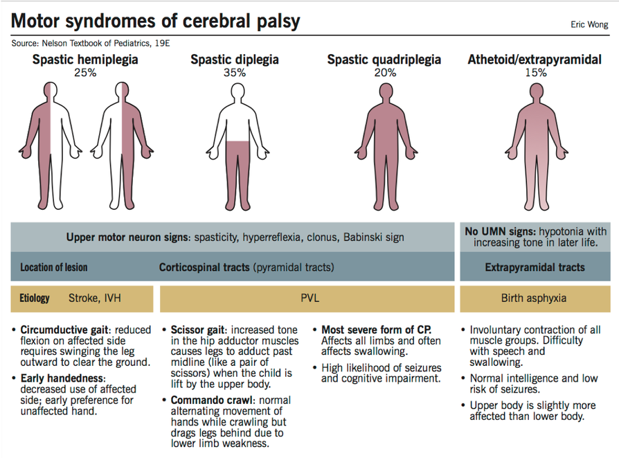 Rogers, L., & Wong, E. (2018). Cerebral palsy. Retrieved February 7 ...