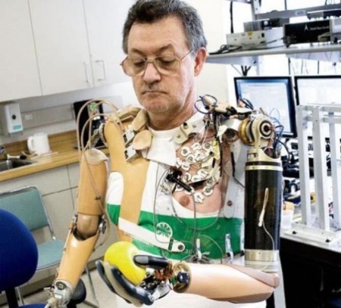 Самый дорогой протез. Джесси Салливан киборг. Джесси Салливан бионические. Бионические протезы. Роботизированные протезы.