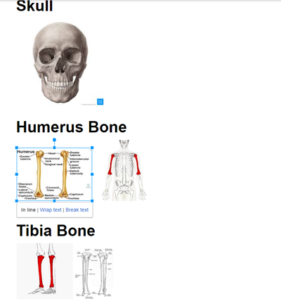 These are images of the skull, humerus, and the tibia bone for the ...