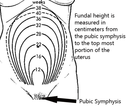 12-32 Wks Gestation (3-8mos) = Measure Fundal Height