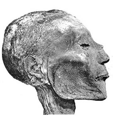 The mummy of Pharaoh Ramses V