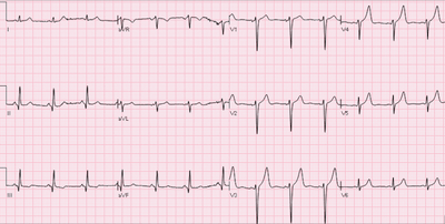 First Cardiologist in America and Electrocardiograph