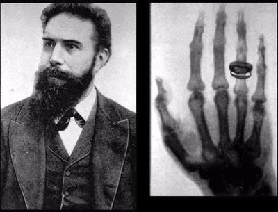 1895: Wilhelm Roentgen , a German physicist, discovers the x-ray . In ...