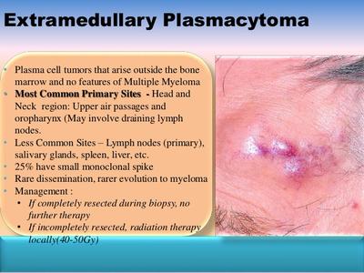 This image shows what exttramedullary plasmacytoma would look like on a patient.
